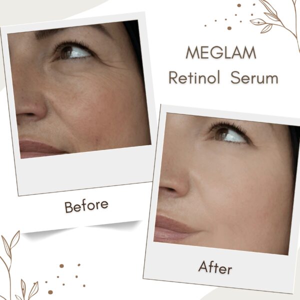 Retinol Anti-Ageing Serum - Image 5